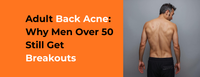 Adult back acne in men over 50 showing breakouts