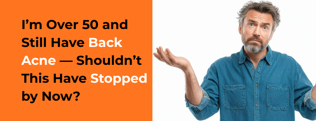 I’m Over 50 and Still Have Back Acne — Shouldn’t This Have Stopped by Now?